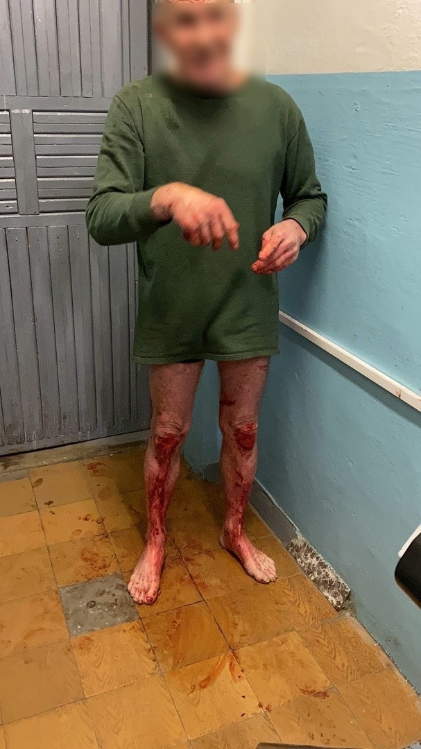 Мужчина без штанов задержан на проходной в Магнитогорске. Он был весь в крови